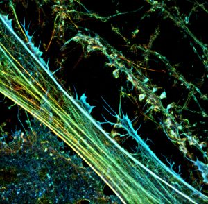 3D-STORM image of a neuronal culture labeled for actin (depth color-code)