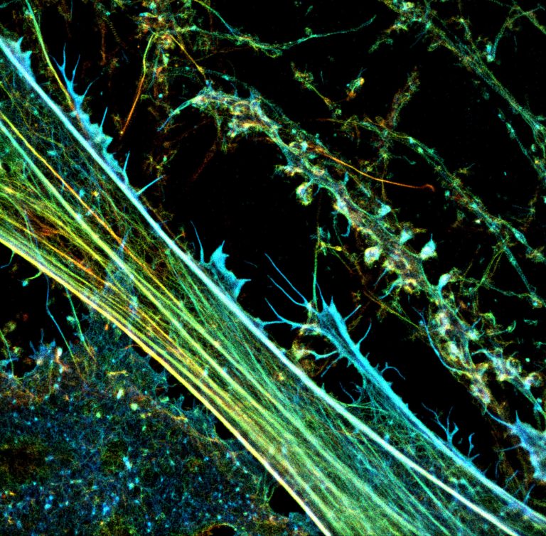 3D-STORM image of a neuronal culture labeled for actin (depth color-code)