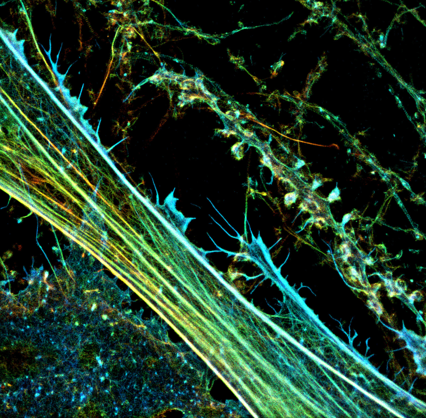 3D-STORM image of a neuronal culture labeled for actin (depth color-code)