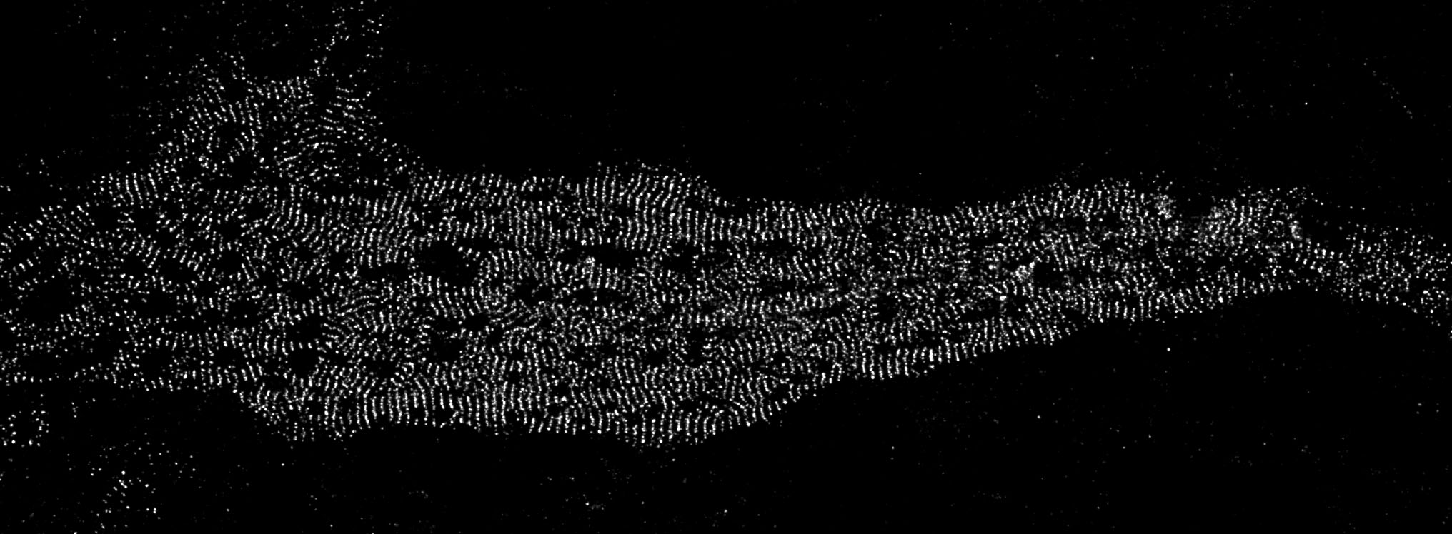STORM image of an axon initial segment labeled for ß4-spectrin