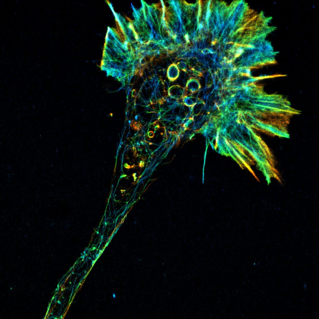 3D-STORM image of an axonal growth cone labeled for actin (depth color-code)