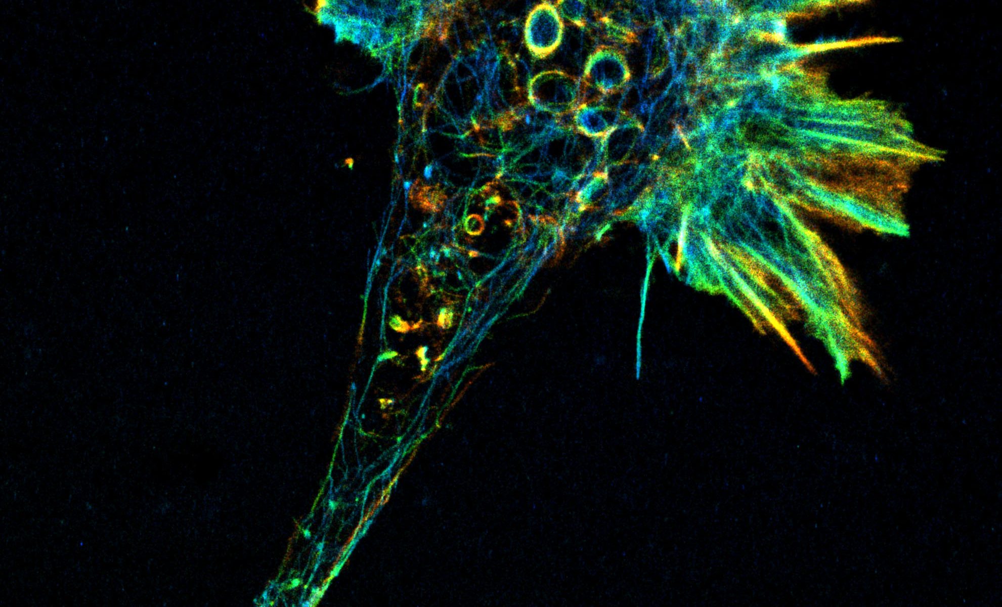 3D-STORM image of an axonal growth cone labeled for actin (depth color-code)