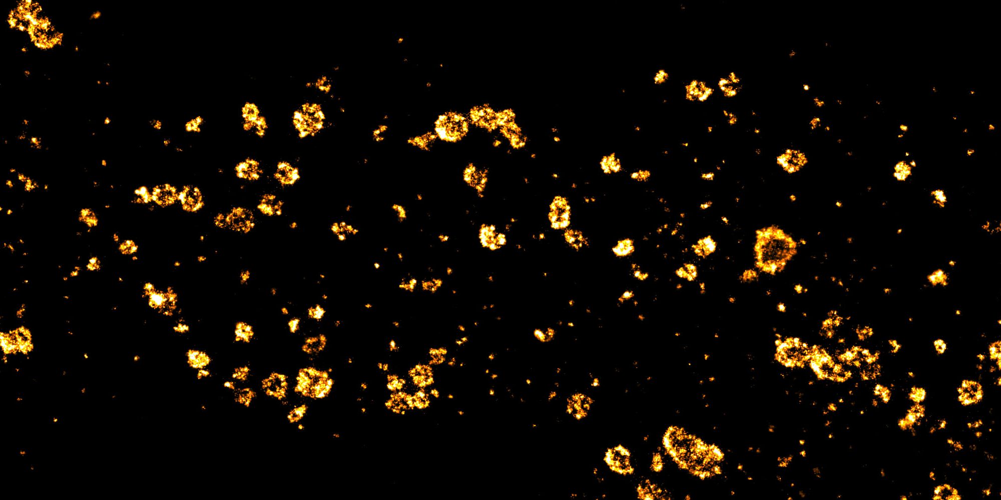 STORM image of a glia labeled for clathrin
