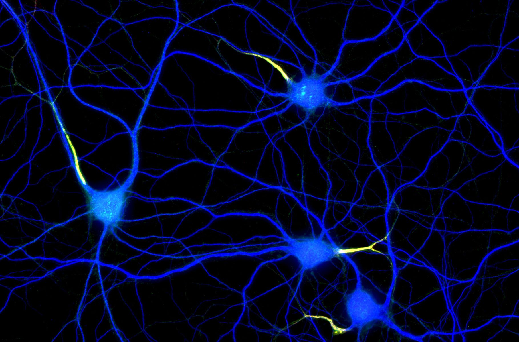 Hippocampal neurons labeled for map2 (blue), ßIV-spectrin (red) and neurofascin (green) Hippocampal neurons labeled for map2 (blue), ßIV-spectrin (red) and neurofascin (green)