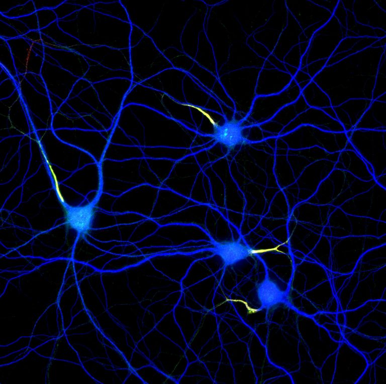 Hippocampal neurons labeled for map2 (blue), ßIV-spectrin (red) and neurofascin (green) Hippocampal neurons labeled for map2 (blue), ßIV-spectrin (red) and neurofascin (green)