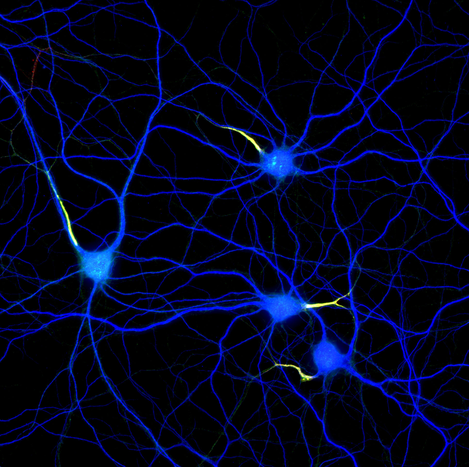 Hippocampal neurons labeled for map2 (blue), ßIV-spectrin (red) and neurofascin (green) Hippocampal neurons labeled for map2 (blue), ßIV-spectrin (red) and neurofascin (green)