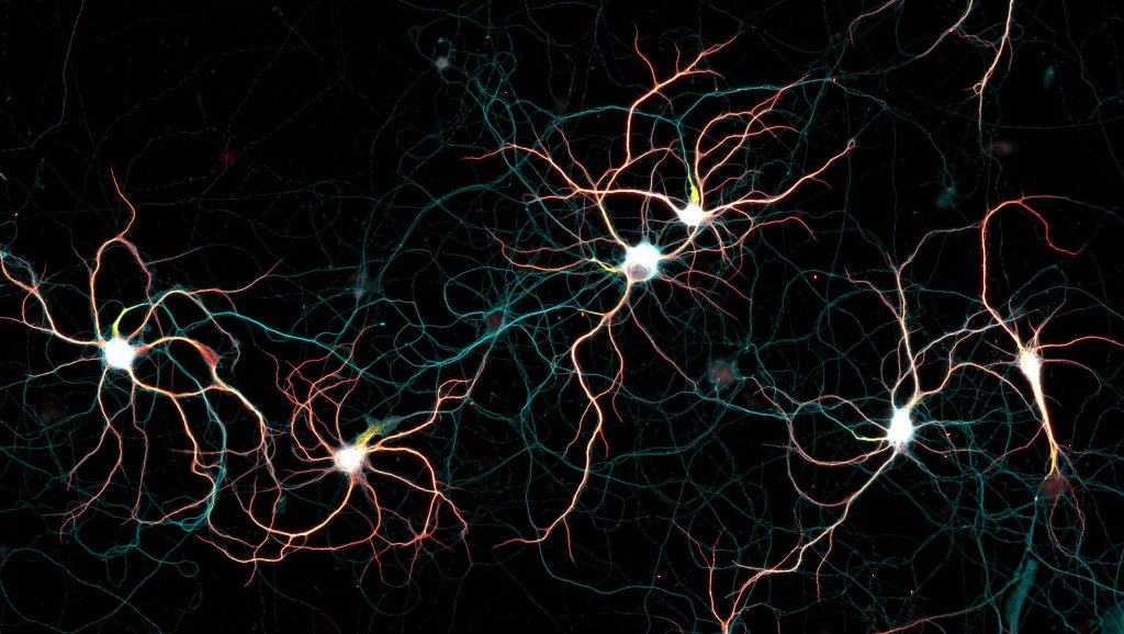 Neuronal culture labeled for map2 (dendrites), spectrin (axon) and neurofascin (AIS)