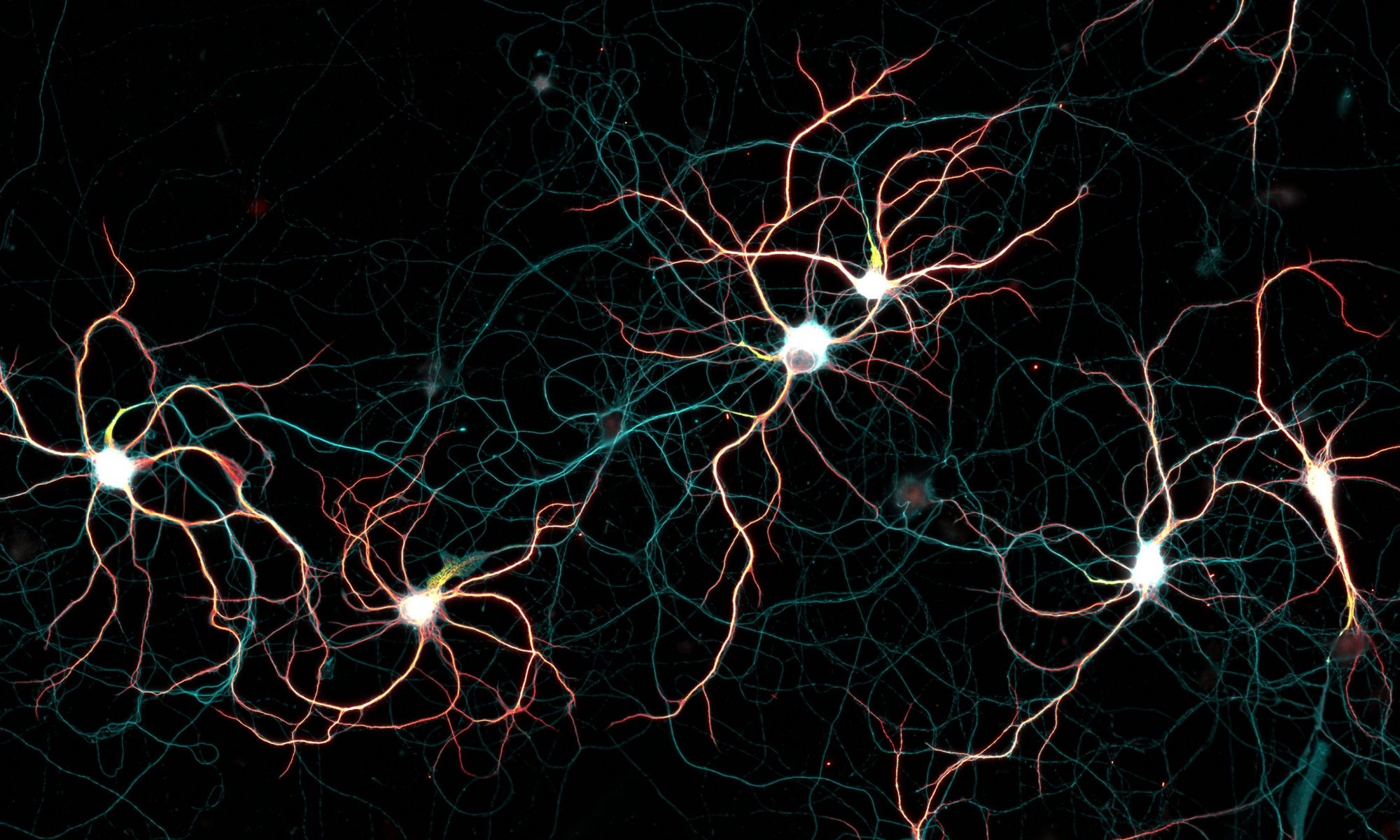 Neuronal culture labeled for map2 (dendrites), spectrin (axon) and neurofascin (AIS) Neuronal culture labeled for map2 (dendrites), spectrin (axon) and neurofascin (AIS)