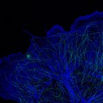 PAINT/STORM image of a COS cell labeled for microtubules (green), clathrin (red) and actin (blue)