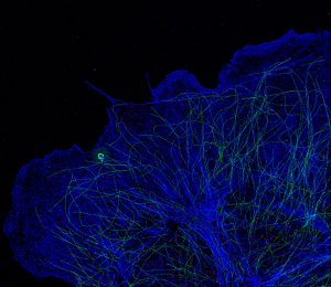 PAINT/STORM image of a COS cell labeled for microtubules (green), clathrin (red) and actin (blue)