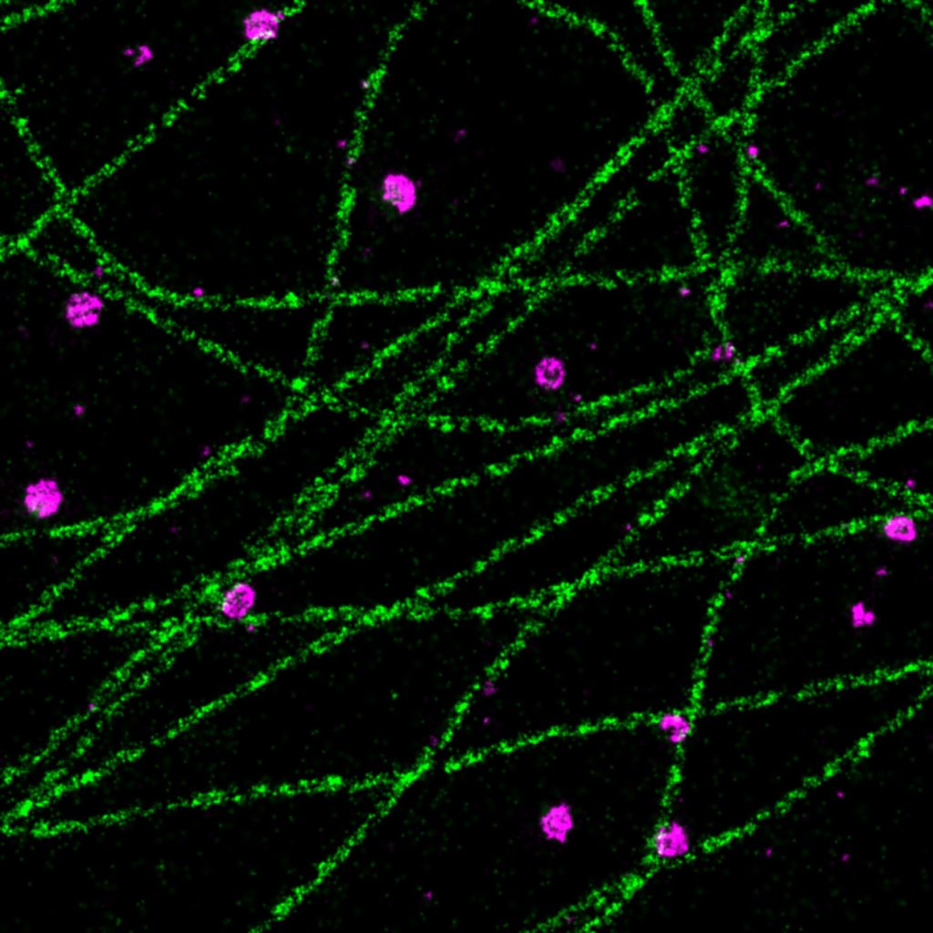 PAINT image of a COS cell labeled for microtubules (green) and clathrin (magenta)