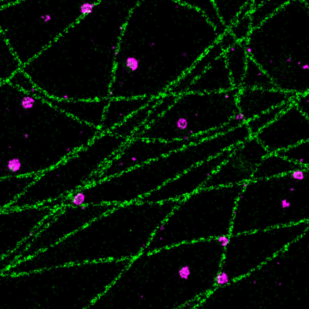 PAINT image of a COS cell labeled for microtubules (green) and clathrin (magenta)
