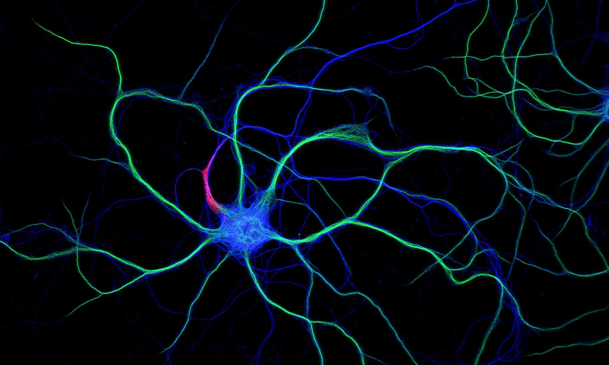 Hippocampal neuron stained for map2 (green), ß2-spectrin (blue) and ß4-spectrin (red) Hippocampal neuron stained for map2 (green), ß2-spectrin (blue) and ß4-spectrin (red)