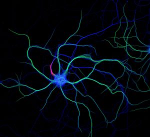 Hippocampal neuron stained for map2 (green), ß2-spectrin (blue) and  ß4-spectrin (red)