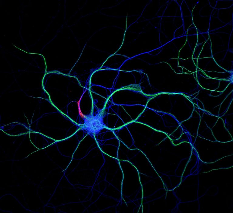 Hippocampal neuron stained for map2 (green), ß2-spectrin (blue) and ß4-spectrin (red) Hippocampal neuron stained for map2 (green), ß2-spectrin (blue) and ß4-spectrin (red)