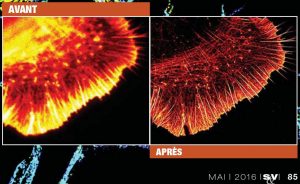 Glia labeled for actin: TIRF image (left) and STORM image (right), as published in Sciences & Vie, May 2016 issue