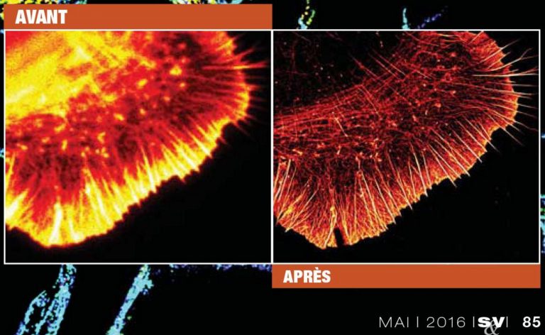 Glia labeled for actin: TIRF image (left) and STORM image (right), as published in Sciences & Vie, May 2016 issue
