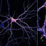 Synapses (green) on an hippocampal neuron (map2, blue; actin, fire). Synapses (green) on an hippocampal neuron (map2, blue; actin, fire).