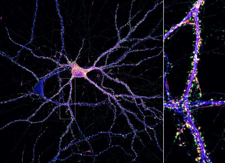 Synapses (green) on an hippocampal neuron (map2, blue; actin, fire). Synapses (green) on an hippocampal neuron (map2, blue; actin, fire).