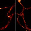 Neuronal axon labeled for actin: TIRF image (left) and STORM image (right)