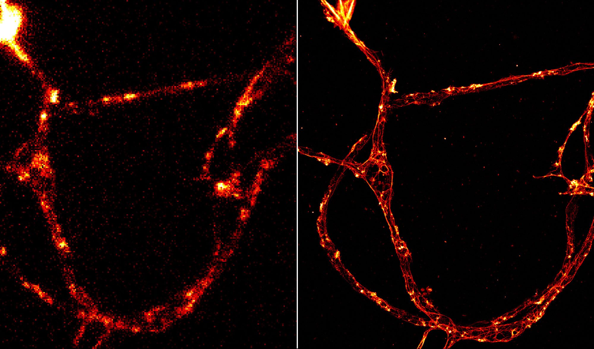 Neuronal axon labeled for actin: TIRF image (left) and STORM image (right)