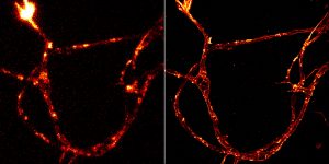 Neuronal axon labeled for actin: TIRF image (left) and STORM image (right)