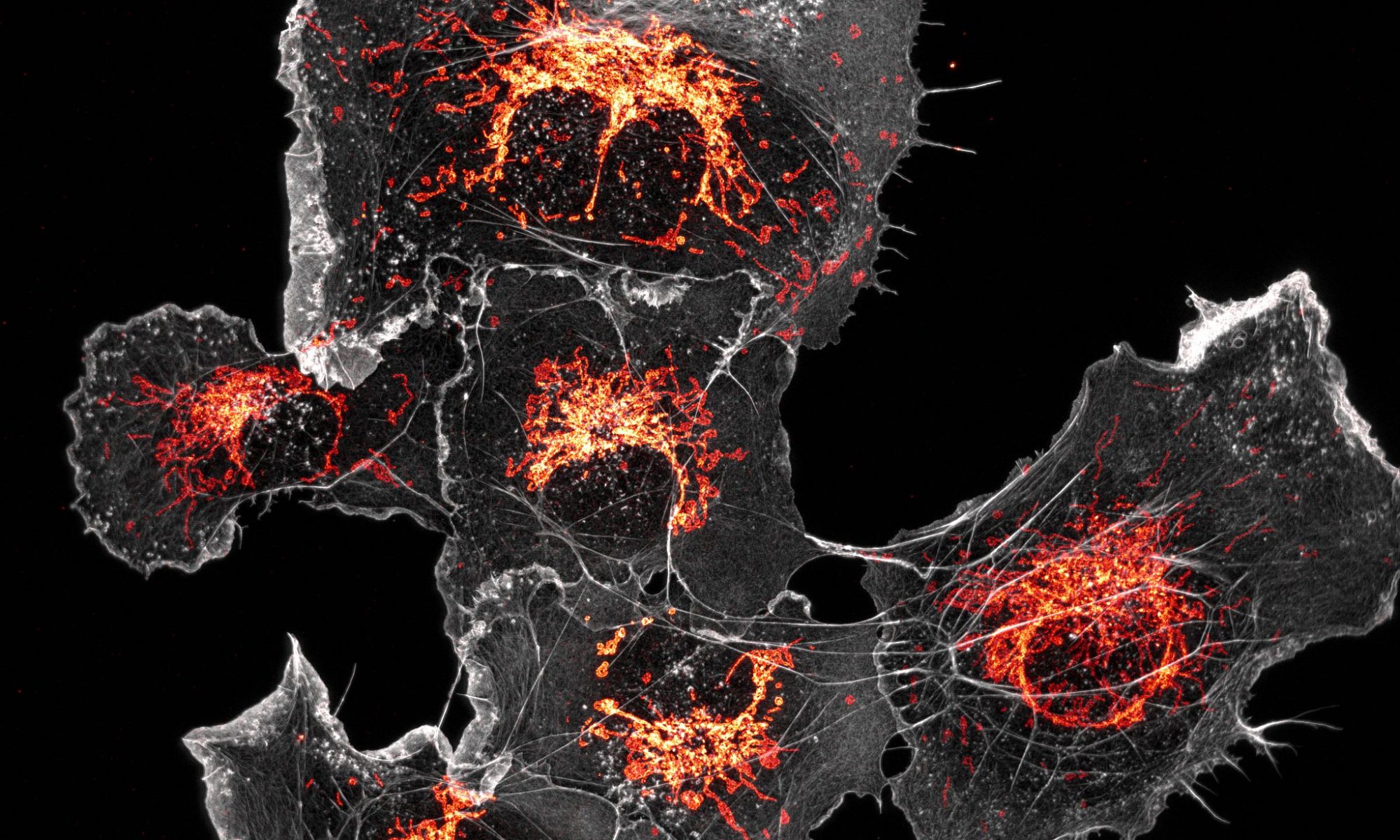 COS cells labeled for mitochondria (orange) and actin (grey) COS cells labeled for mitochondria (orange) and actin (grey)