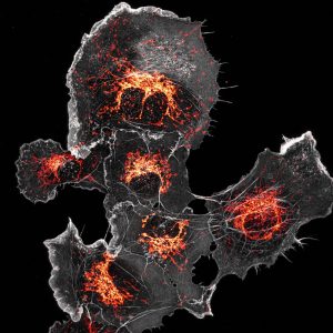 COS cells labeled for mitochondria (orange) and actin (grey) COS cells labeled for mitochondria (orange) and actin (grey)