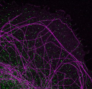 2-color PAINT image of microtubules (magenta) and clathrin (green) in a COS cell 2-color PAINT image of microtubules (magenta) and clathrin (green) in a COS cell