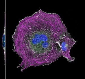 COS cell labeled for microtubules (magenta), actin (grey), clathrin (green) and nucleus (blue) COS cell labeled for microtubules (magenta), actin (grey), clathrin (green) and nucleus (blue)