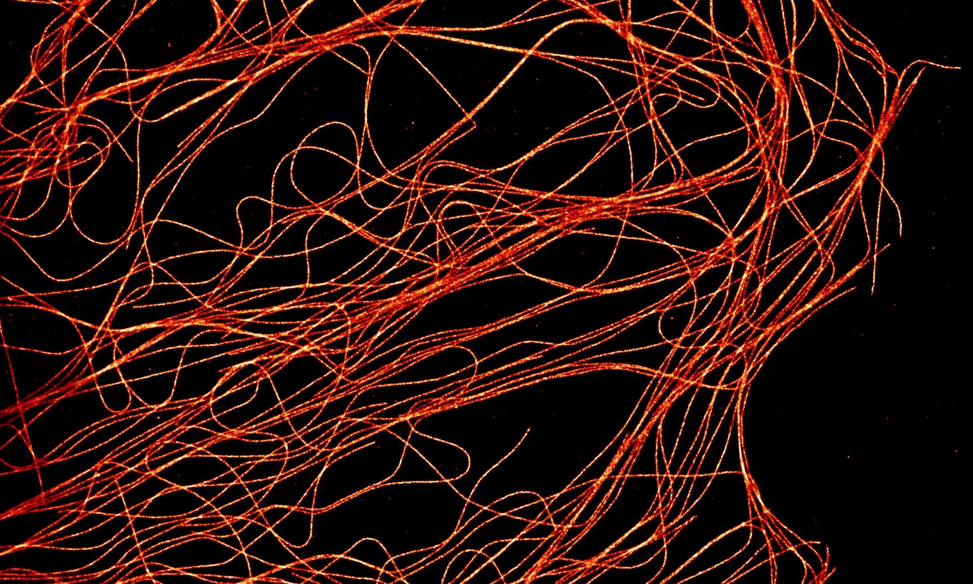 STORM image of microtubules in a COS cell STORM image of microtubules in a COS cell