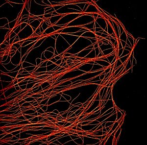 STORM image of microtubules in a COS cell STORM image of microtubules in a COS cell