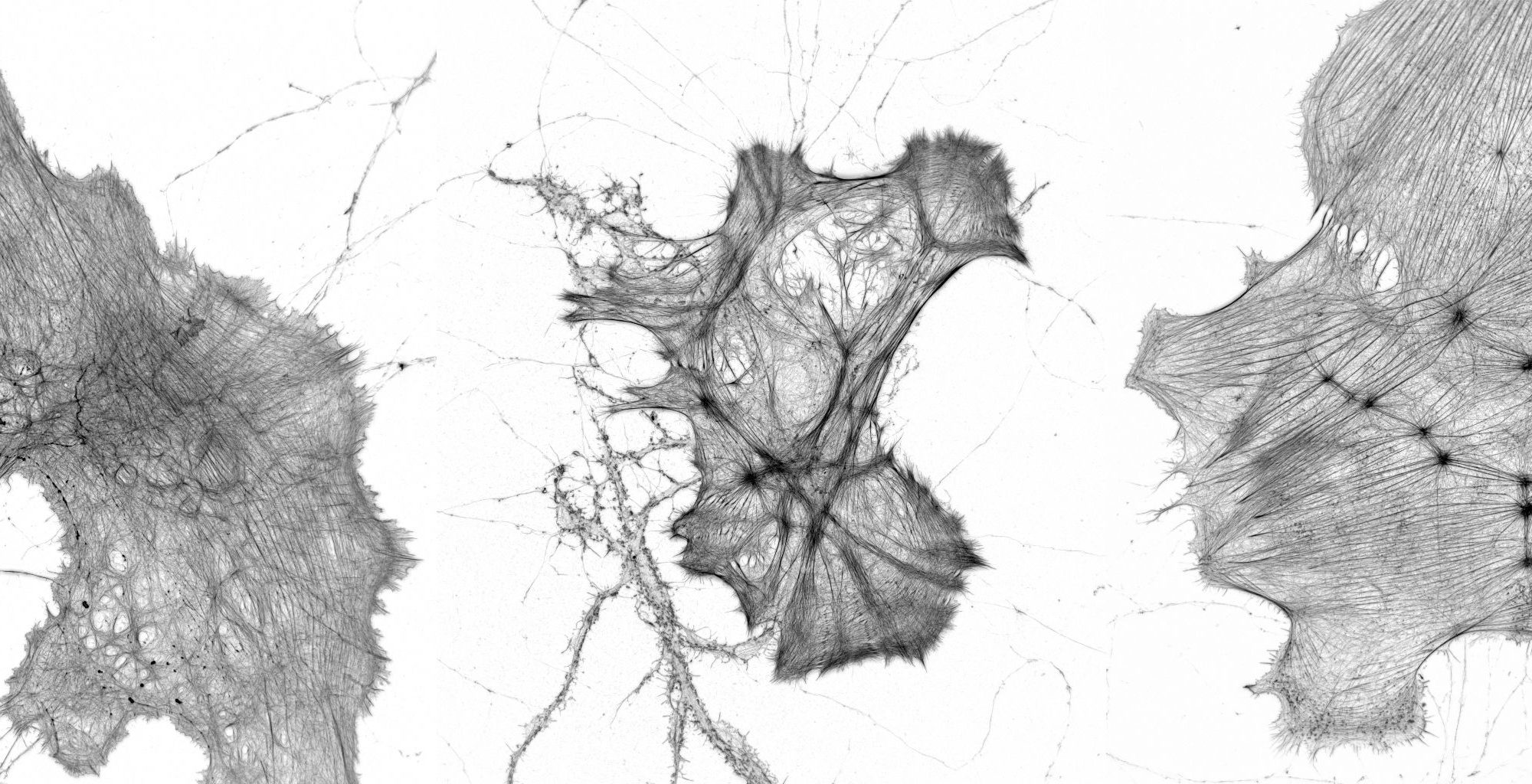 Gallery of glias labeled for actin Gallery of glias labeled for actin