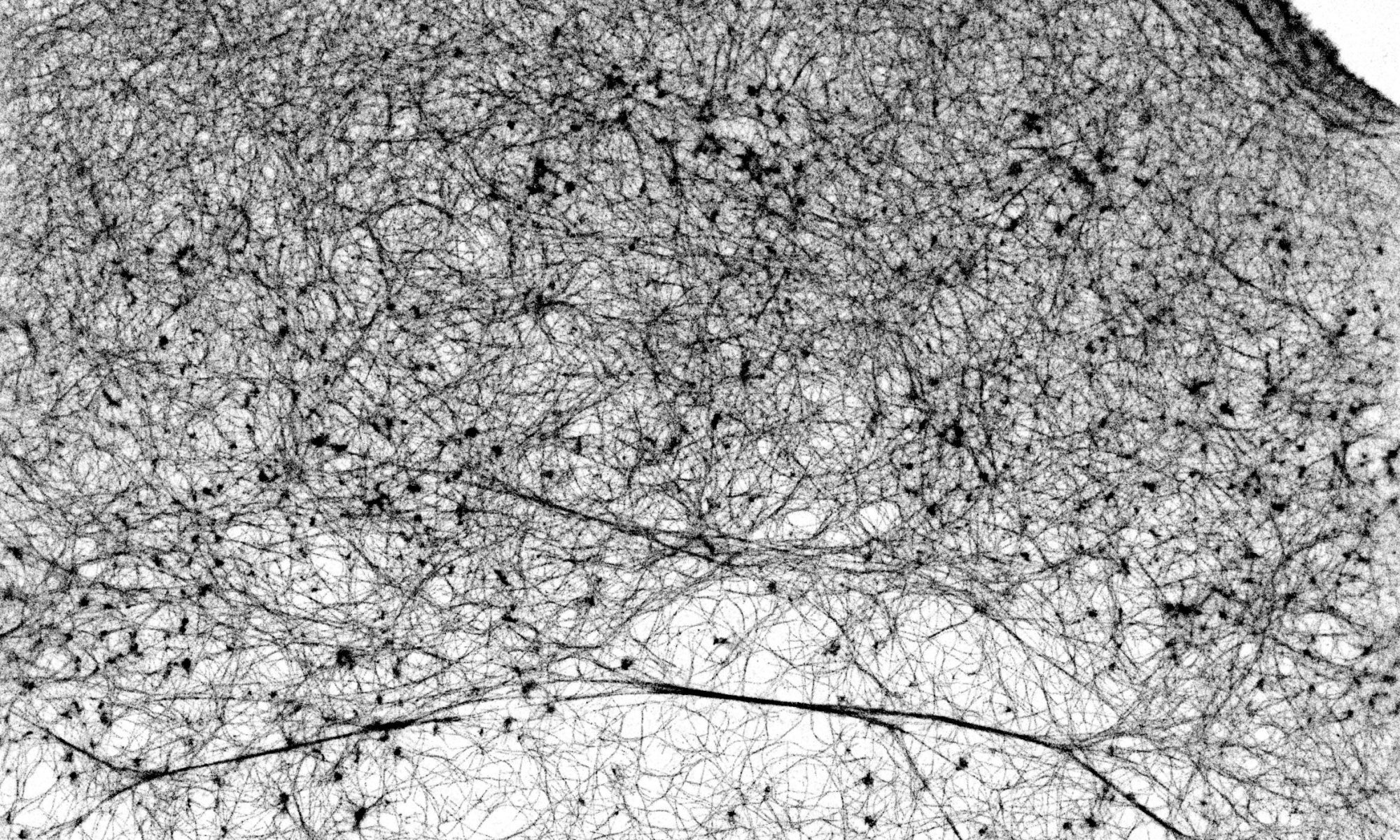 STORM image of a COS cell labeled for actin