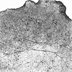 STORM image of a COS cell labeled for actin STORM image of a COS cell labeled for actin