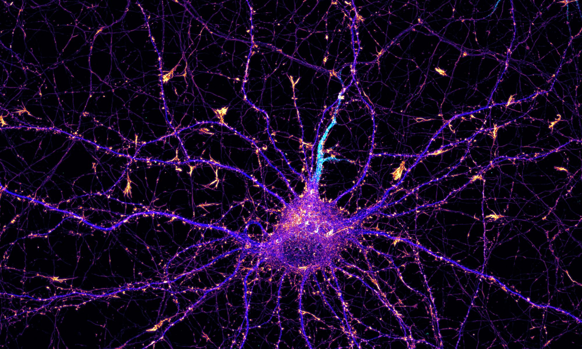 Hippocampal neuron labeled for actin (fire), map2 (blue) and neurofascin (cyan) Hippocampal neuron labeled for actin (fire), map2 (blue) and neurofascin (cyan)