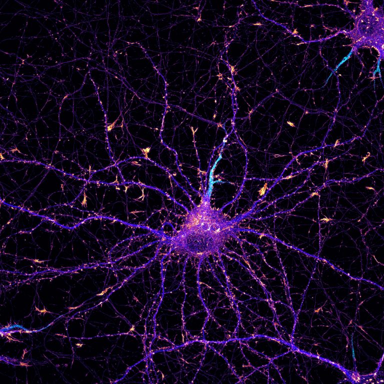Hippocampal neuron labeled for actin (fire), map2 (blue) and neurofascin (cyan) Hippocampal neuron labeled for actin (fire), map2 (blue) and neurofascin (cyan)