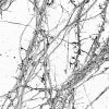 STORM image of actin in hippocampal neurons STORM image of actin in hippocampal neurons