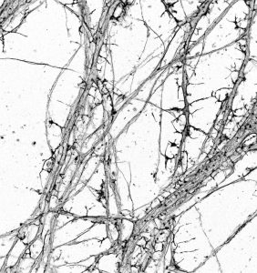 STORM image of actin in hippocampal neurons STORM image of actin in hippocampal neurons