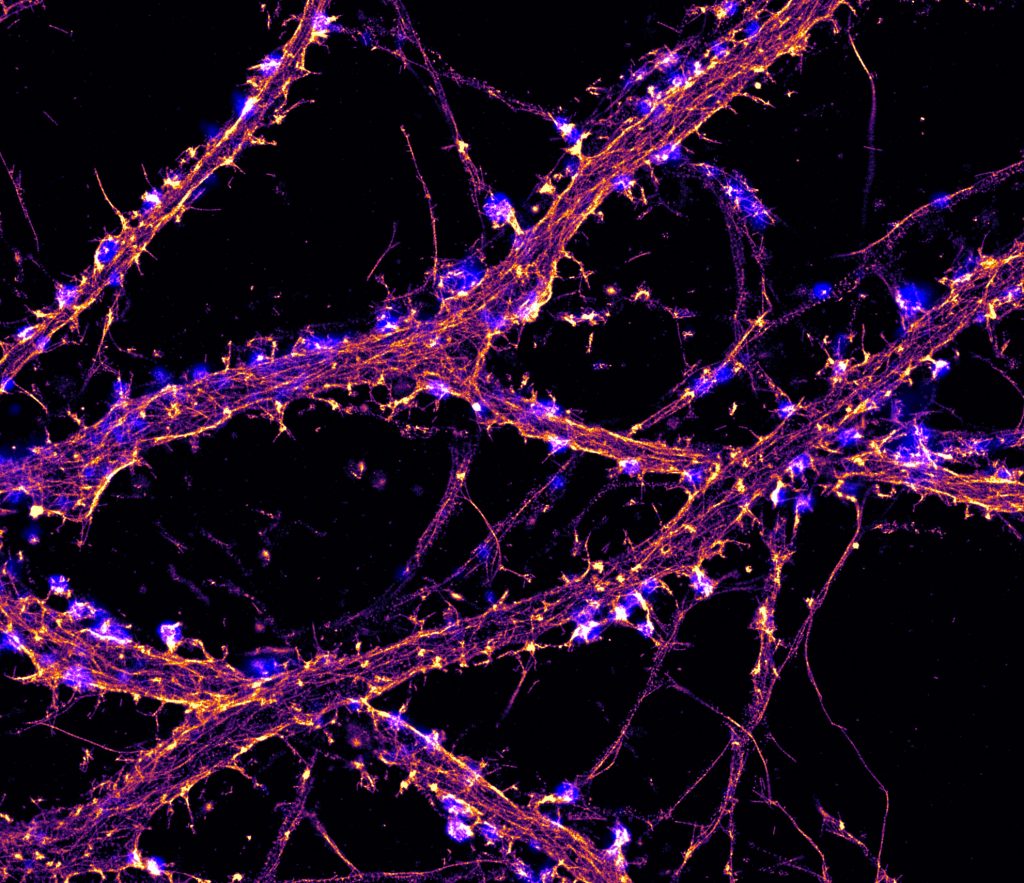 STORM image of actin (fire) with labeling for synapses (blue) in hippocampal neurons STORM image of actin (fire) with labeling for synapses (blue) in hippocampal neurons