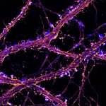 STORM image of actin (fire) with labeling for synapses (blue) in hippocampal neurons STORM image of actin (fire) with labeling for synapses (blue) in hippocampal neurons