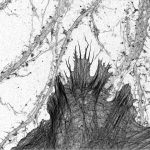 Hippocampal neurons and glia labeled for actin and imaged by STORM