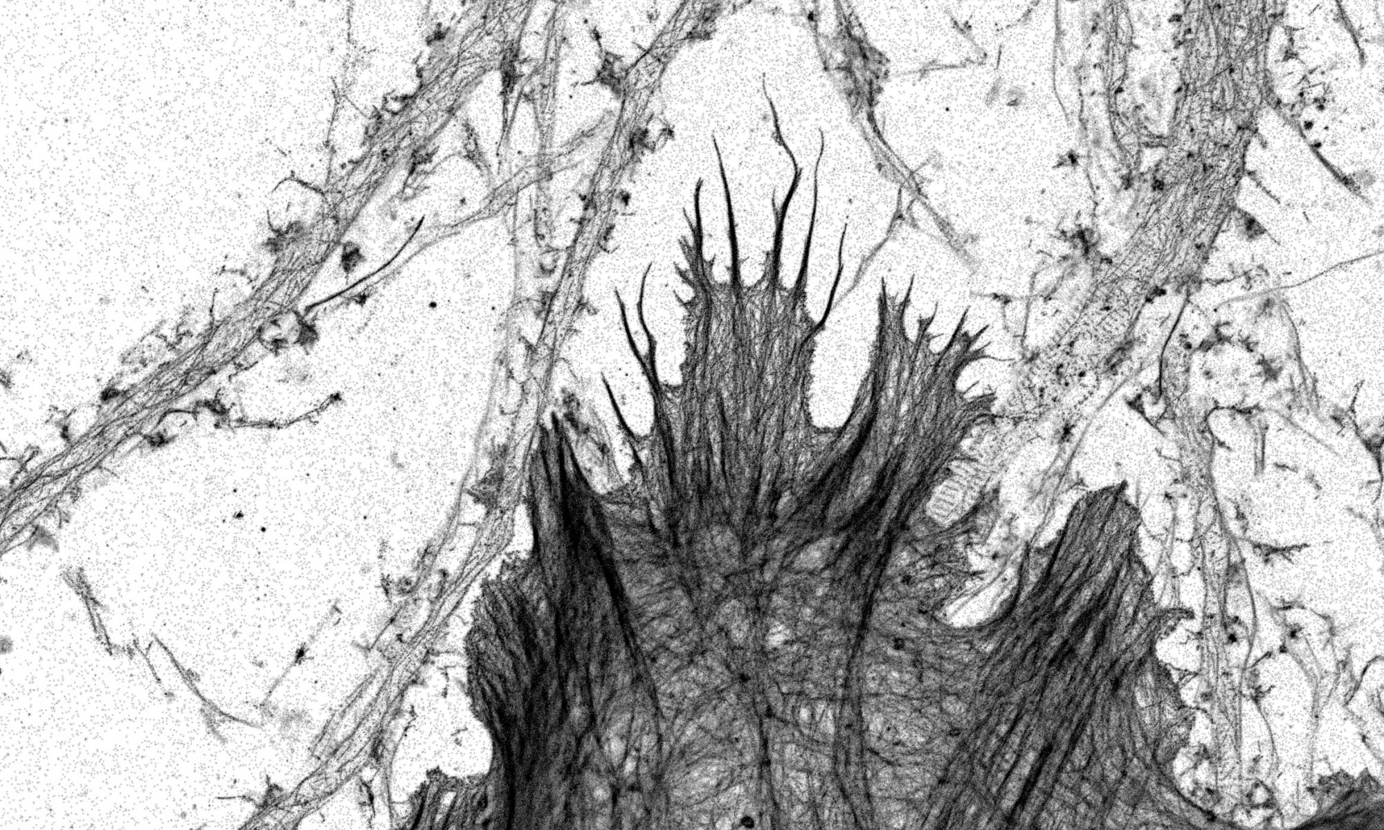 Hippocampal neurons and glia labeled for actin and imaged by STORM