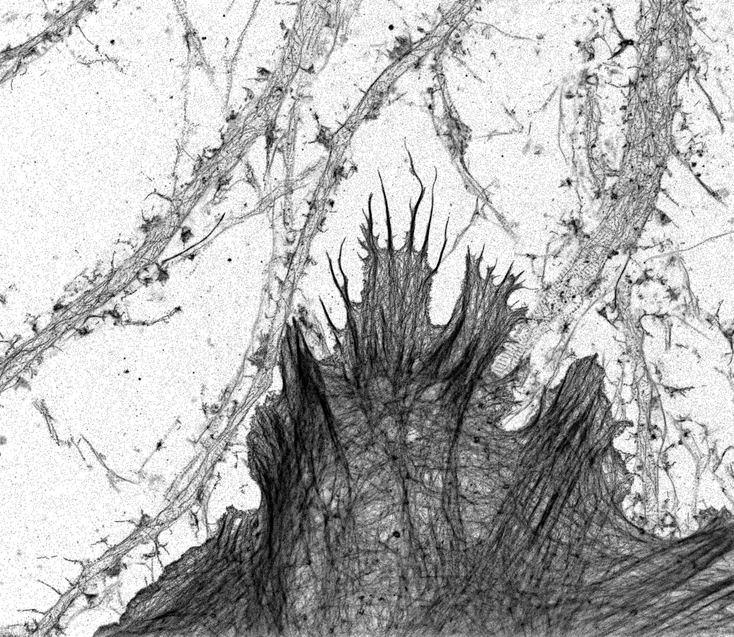 Hippocampal neurons and glia labeled for actin and imaged by STORM