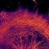 STORM image of a glia labeled for actin