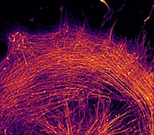 STORM image of a glia labeled for actin