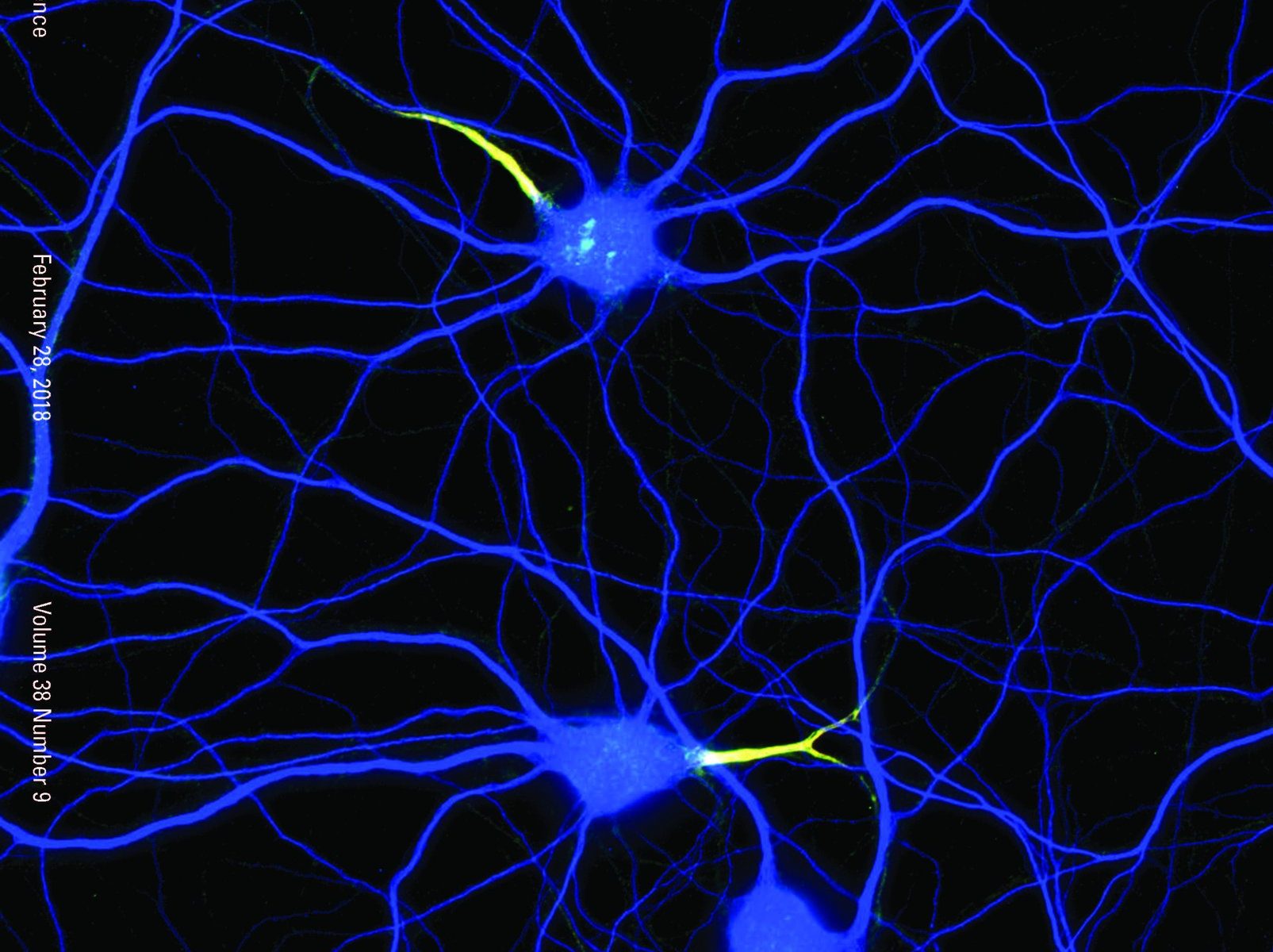 Neurons stained for map2 (blue), neurofascin (green) and b4-spectrin (red), cover of J. Neuroscience, 28 Feb. 2018 Neurons stained for map2 (blue), neurofascin (green) and b4-spectrin (red), cover of J. Neuroscience, 28 Feb. 2018