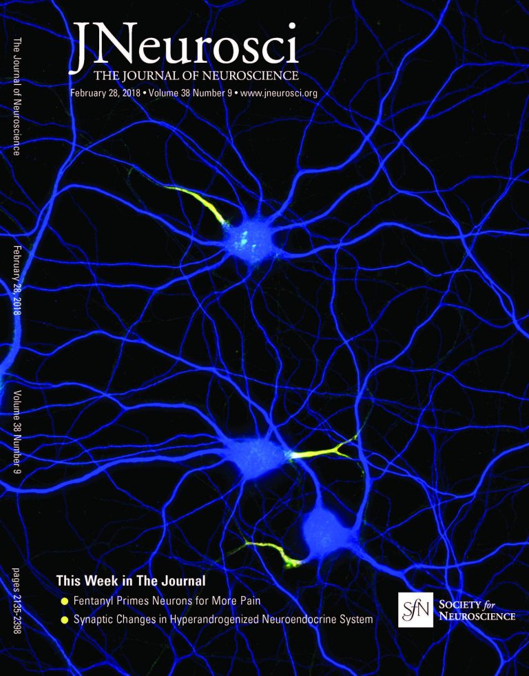 Neurons stained for map2 (blue), neurofascin (green) and b4-spectrin (red), cover of J. Neuroscience, 28 Feb. 2018 Neurons stained for map2 (blue), neurofascin (green) and b4-spectrin (red), cover of J. Neuroscience, 28 Feb. 2018